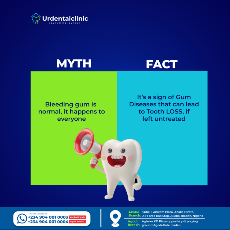 Causes of Bleeding Gums and Treatment